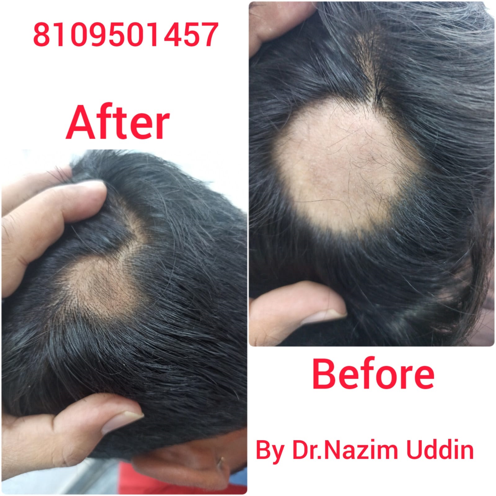 Skin Treatment